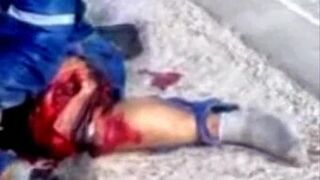 Ciclistas con trauma masivo en la pierna